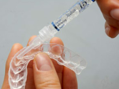 Home-Bleach-Apply-Gel-400-x-300-PX