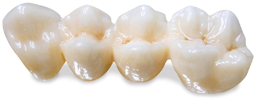 zirkonyum-dis-cercon